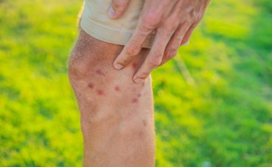 Các điềm báo quan trọng khác cần biết khi bị chuột cắn