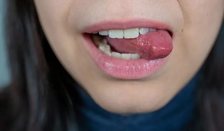 Khi đang trò chuyện, nếu đột nhiên cắn vào lưỡi thì bạn cũng cần lưu ý vì ai đó có thể đang nhắc đến bạn.