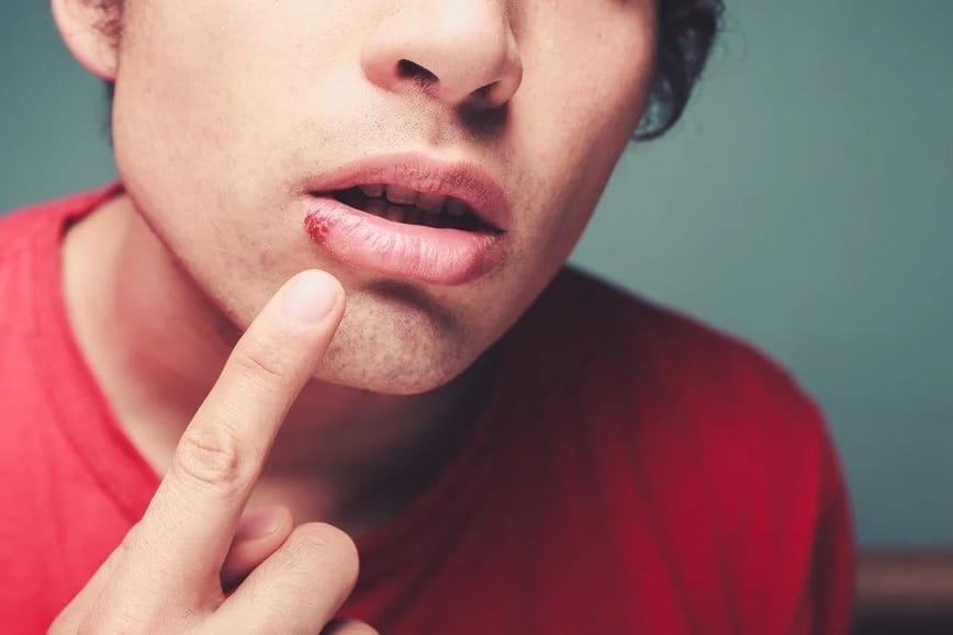 Nên đánh đề con nào khi cắn vào môi?